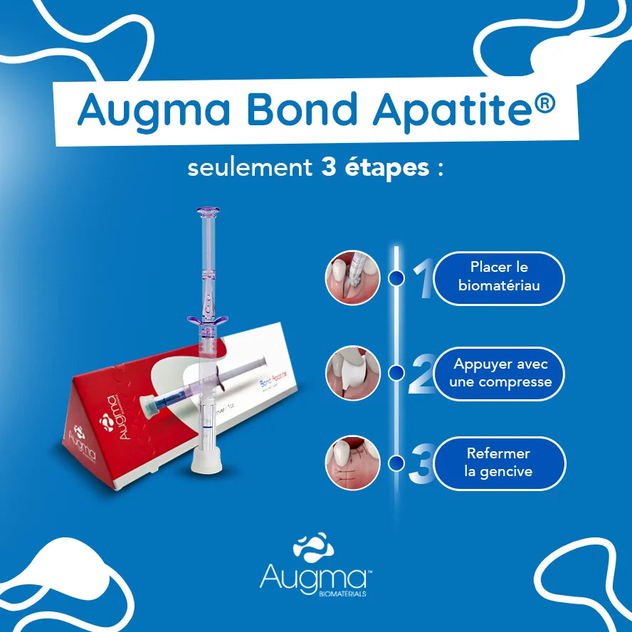 Bond Apatite™ 1 seringue - comblement osseux instantané | Augma Biomaterials™