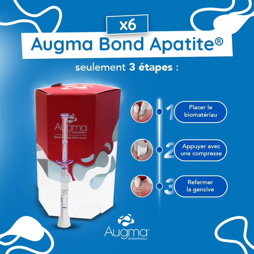 boite 6x Bond Apatite™ comblement osseux instantané par Augma Biomaterials™ - oofti.fr
