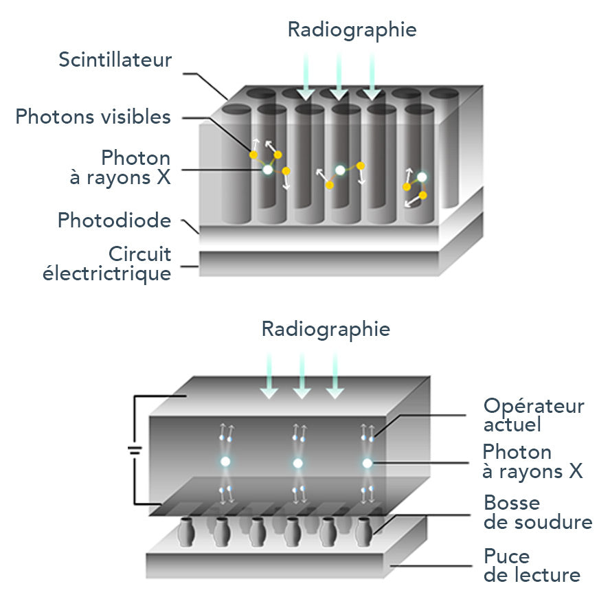 Capteur intra-oral X-ray sensor - XPECT VISION - oofti.fr