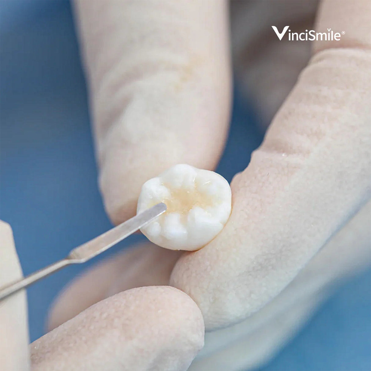 TrusFIL - Universal Restorative Composite - 4g/syringe - VinciSmile