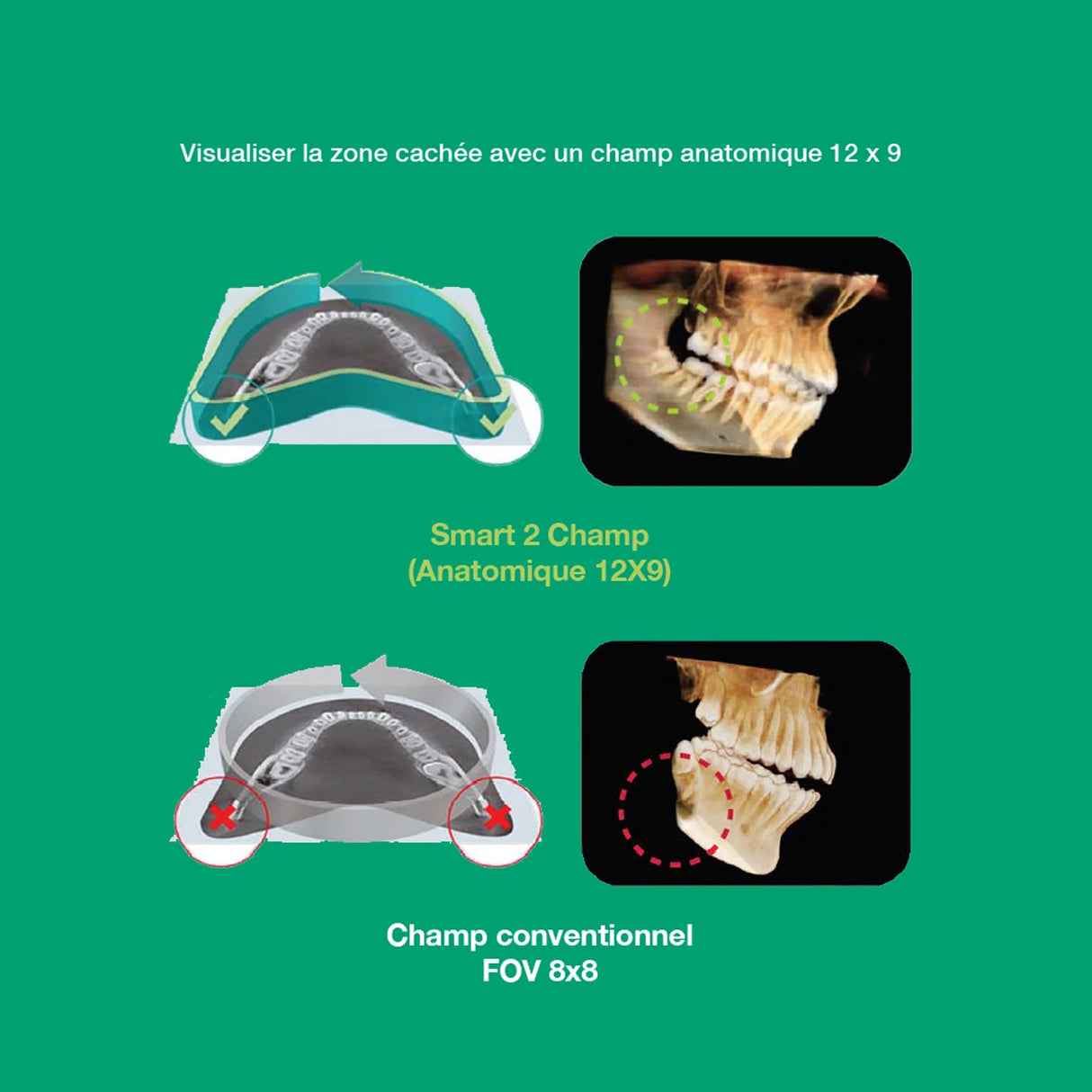 Système d’imagerie CT & panoramique 3D / 2D - Smart 2 - Vatech - oofti.fr