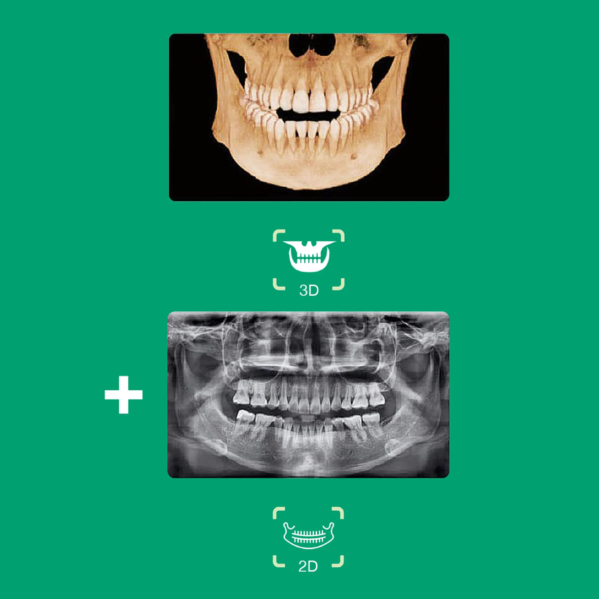 Système d’imagerie CT & panoramique 3D / 2D - Smart 2 - Vatech - oofti.fr