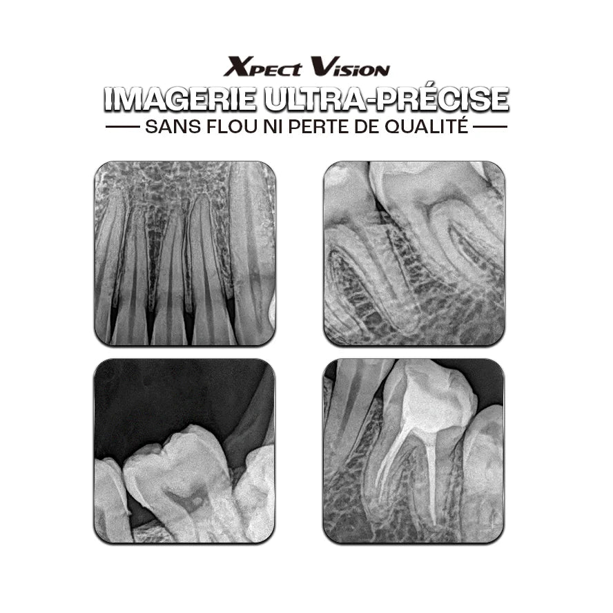 Capteur intra-oral X-ray sensor | Xpect Vision - oofti.fr