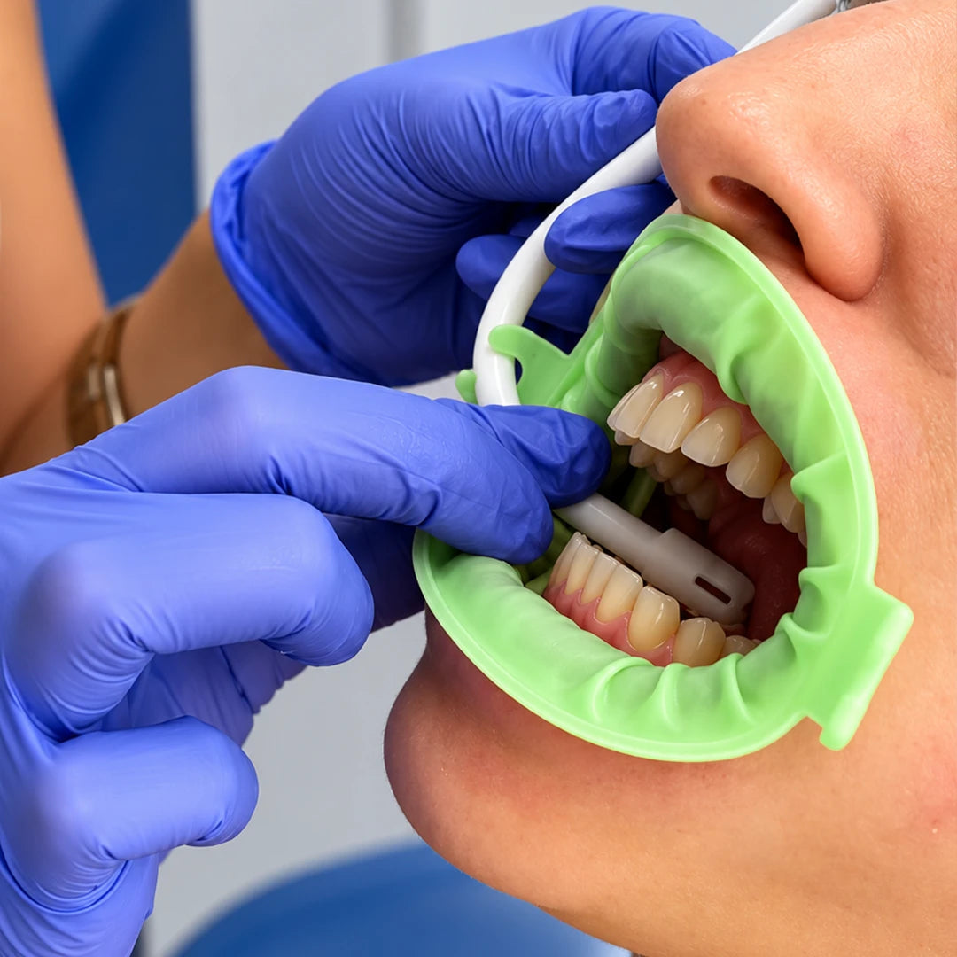 Separador dental en forma de O - Cotisen