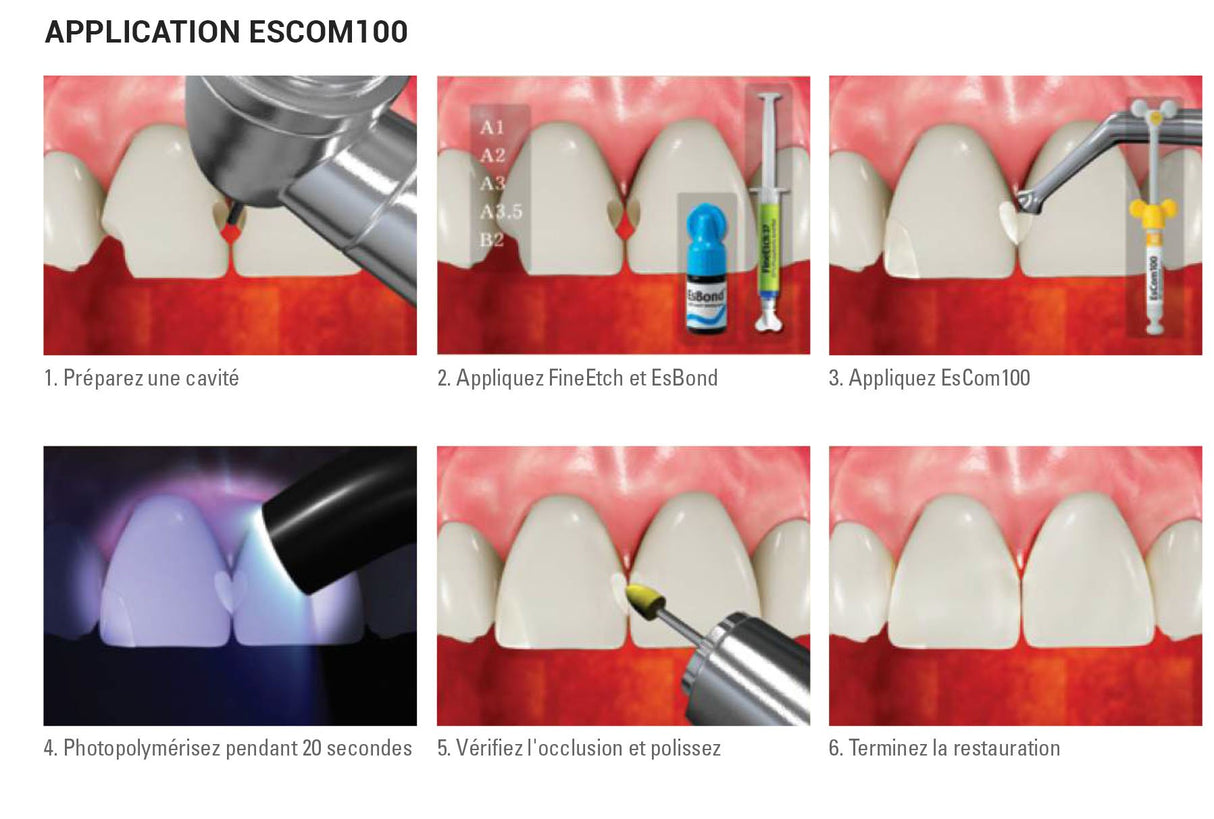 EsCom100 - A1 - 1x 4g Résine composite nano-hybride restauratrice photopolymérisable - oofti.fr