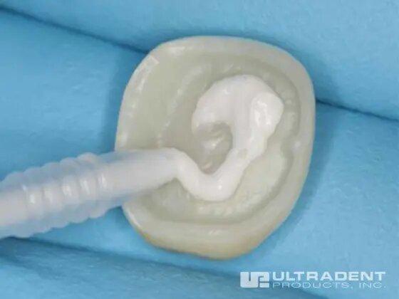 Ciment verre ionomère UltraCem - 20 seringues de 0,3g - oofti.fr