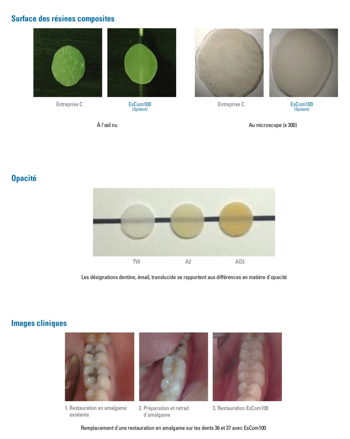1 seringue de4g EsCom100 - B2 - Résine composite nano-hybride restauratrice photopolymérisable - oofti.fr