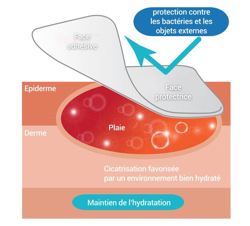 MATBEKA intra-oral boîte 20 pansements XL (50x15mm) - oofti.fr