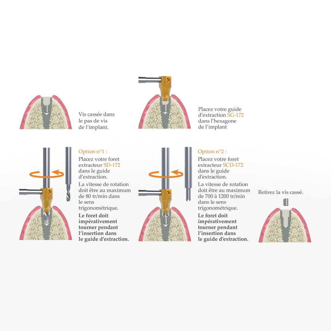 SOS Kit - Extraction rapide & sécurisée de vis d’implant cassées par Safe Implant - oofti.fr