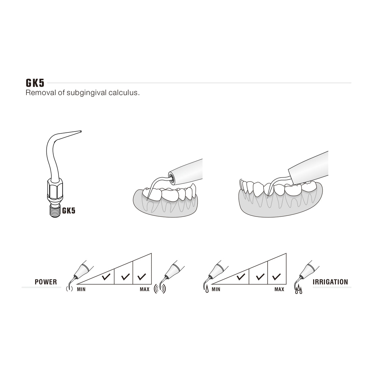 Insert GK5 compatible KAVO UltraResistant UR - oofti.fr