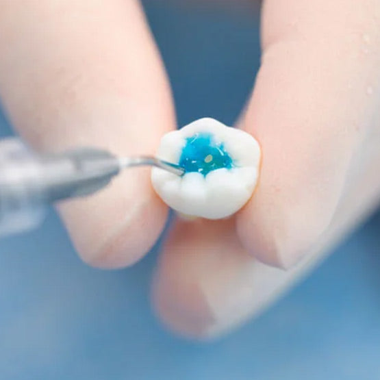 P-Echant - Gel de mordançage à l'acide phosphorique - 3 mL/seringue + 10 embouts - HUGE - oofti.fr