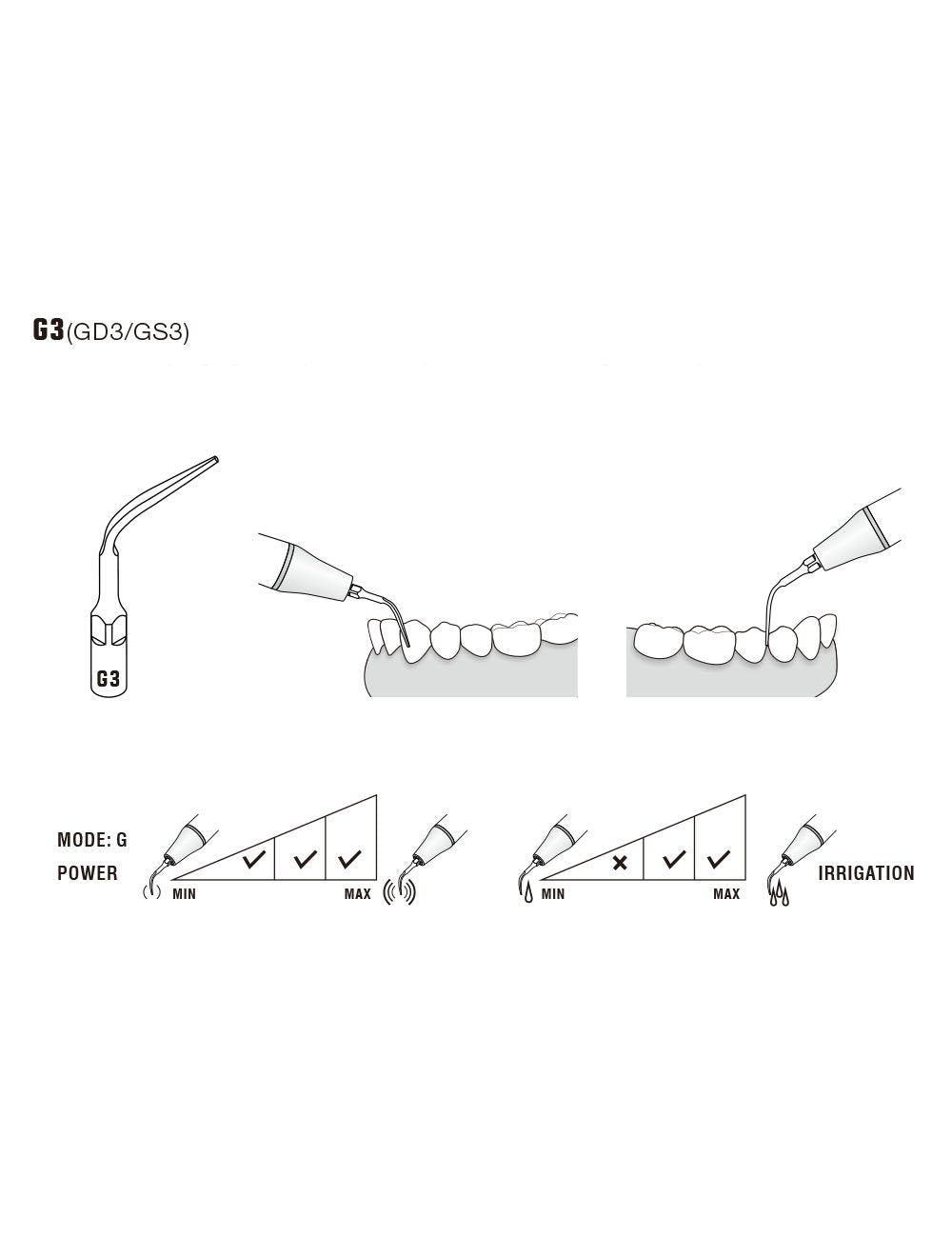 Insert G3 compatible EMS ultrarésistant UR - WOODPECKER - oofti.fr