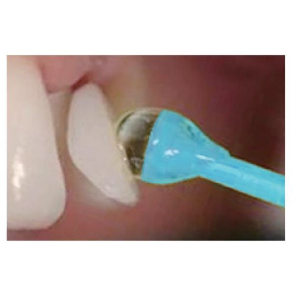 Boîte de 20 micro applicateurs adhésifs - oofti.fr