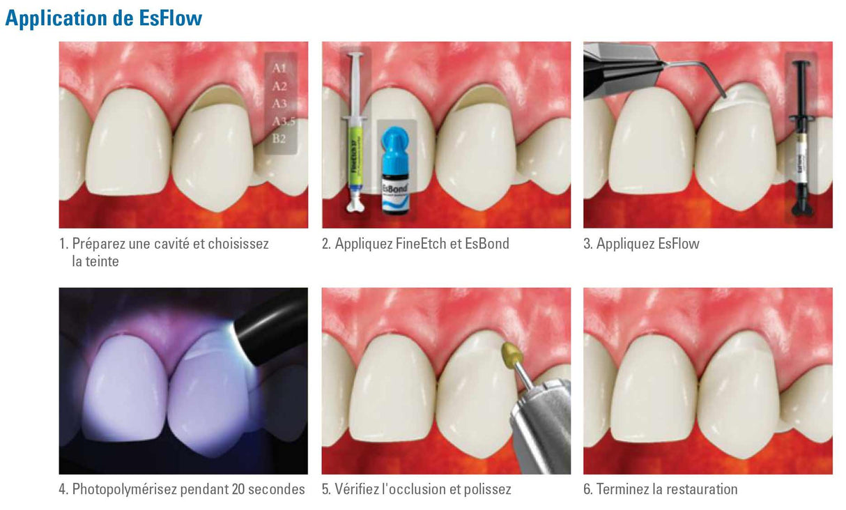 Es Flow A2 (2 seringues x 2g résine composite fluide photopolymérisable) - oofti.fr
