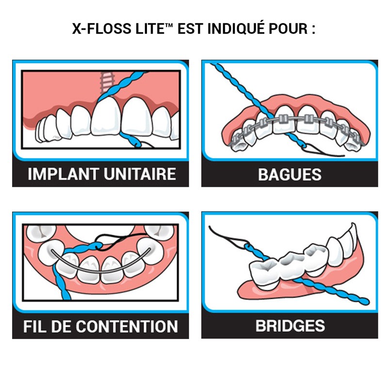 X-Floss lite - oofti.fr