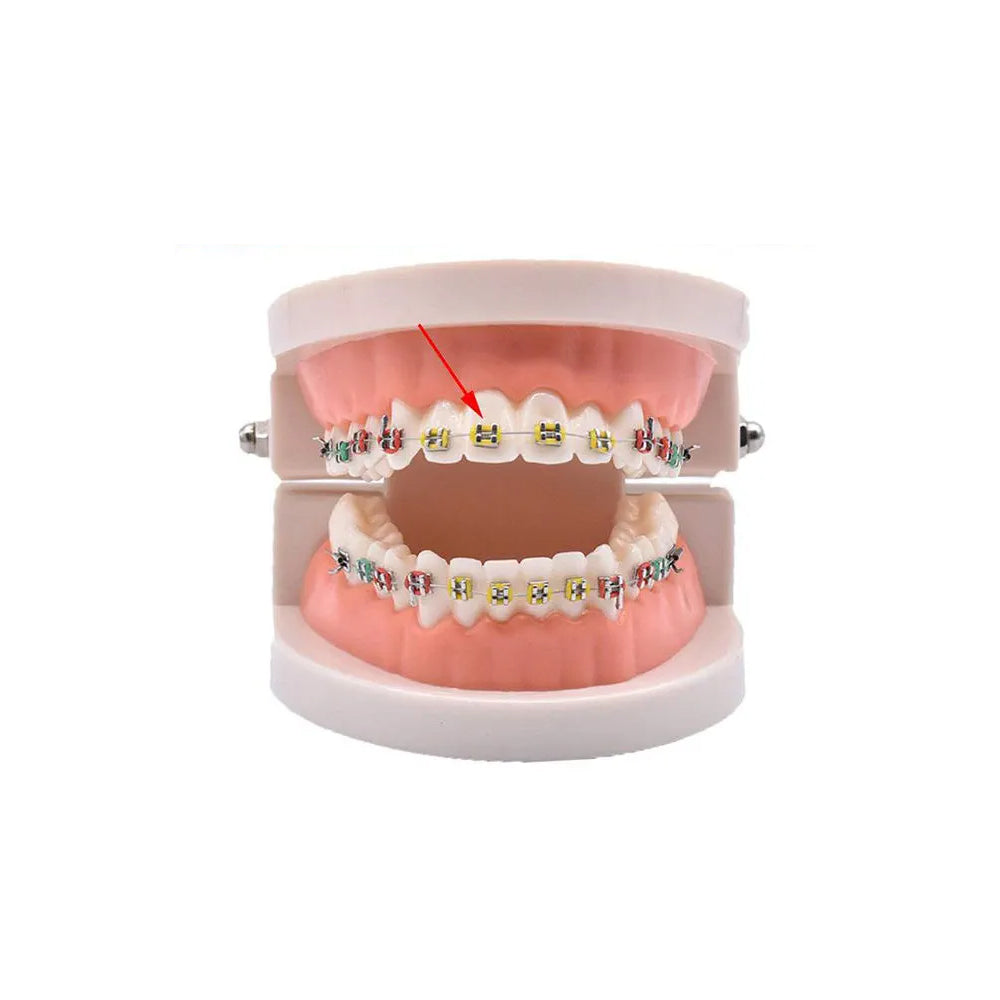 Ligatures élastiques d'orthodontie multicolores