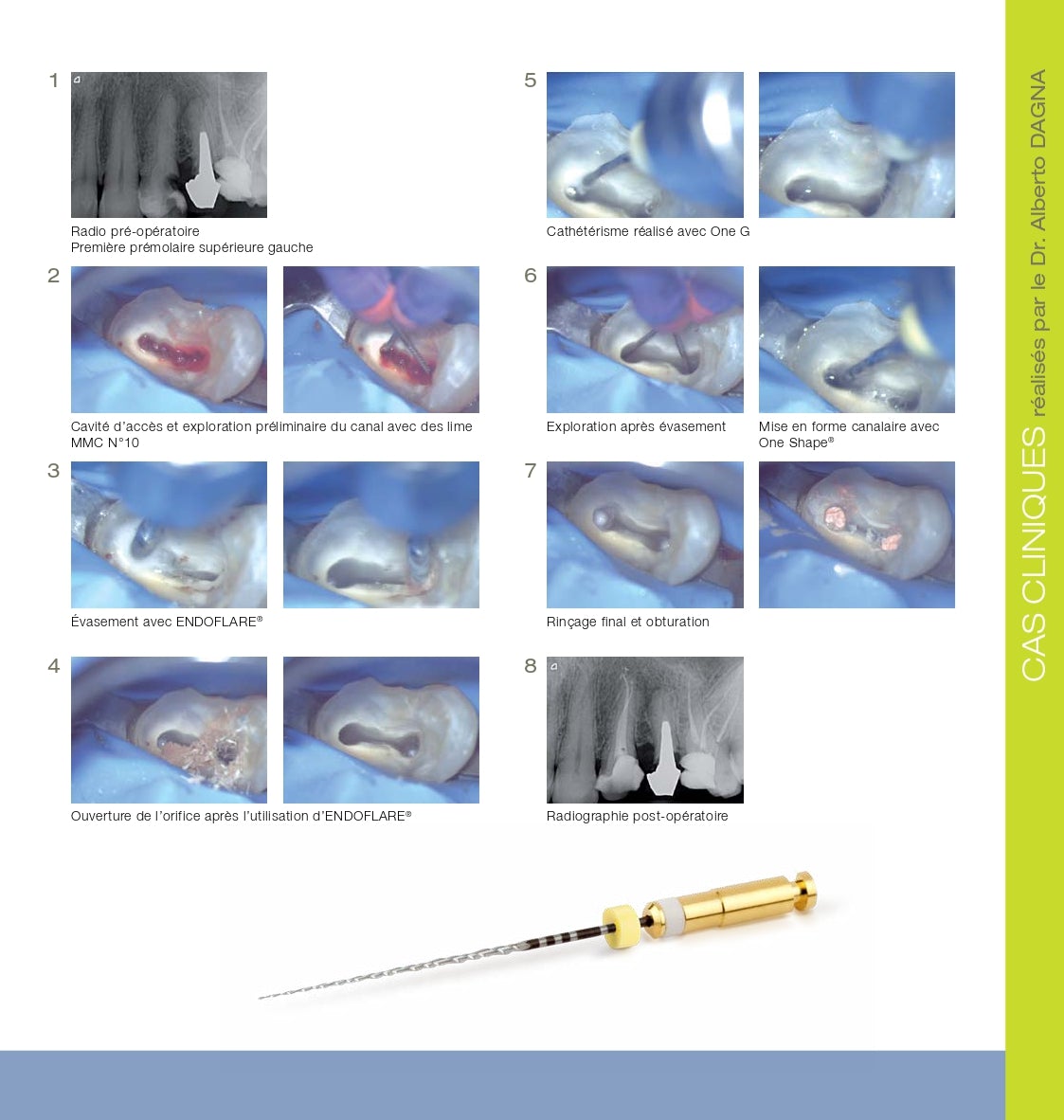 Lot de 6 limes One G NiTi de cathétérisme en rotation continue MicroMega - Dental Coop