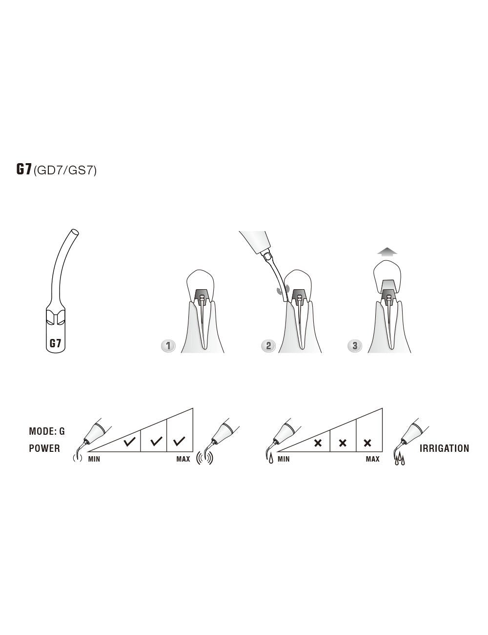 Insert S7 compatible Satelec UltraResistant UR - WOODPECKER - oofti.fr
