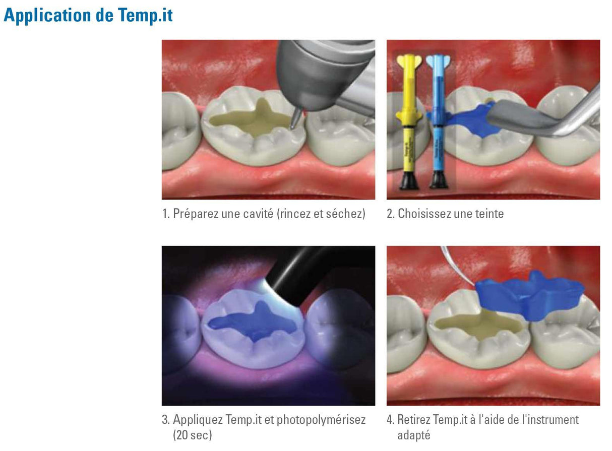 Temp.it 1x 3g Matériau d'obturation temporaire photopolymérisable (jaune) - oofti.fr