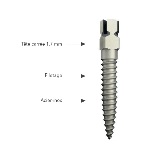 Europosts Inox Screw Post - Anthogyr