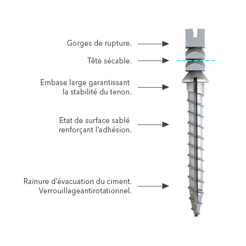 Europosts Titanium Screw Post - Anthogyr