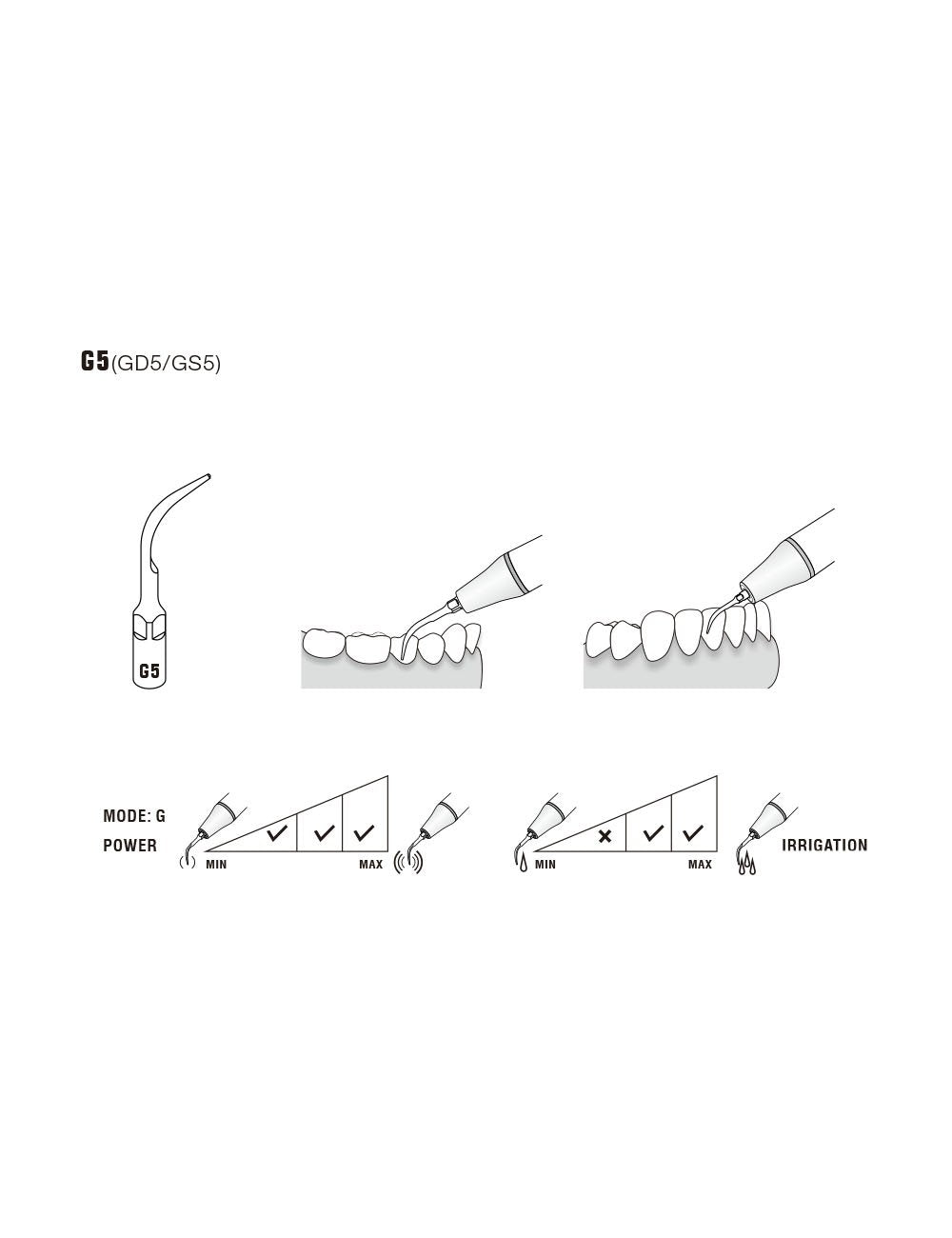Insert GD5 compatible Satelec ultrarésistant UR - WOODPECKER - oofti.fr
