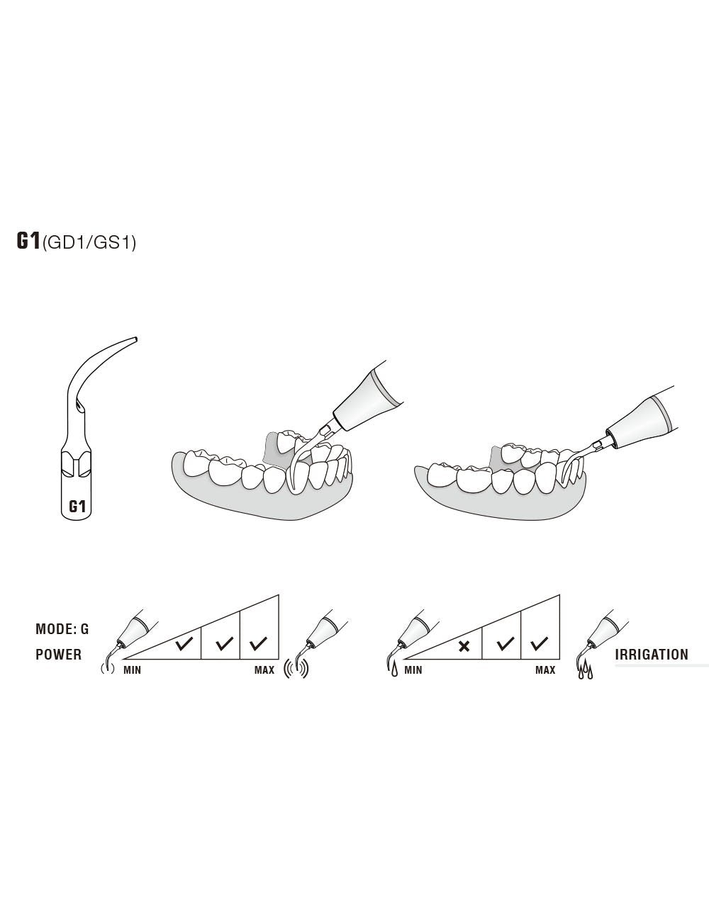 Insert G1 compatible EMS ultrarésistant UR - WOODPECKER - oofti.fr