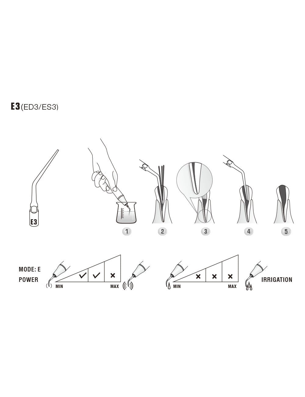 Insert E3 compatible EMS ultrarésistant UR - WOODPECKER - oofti.fr