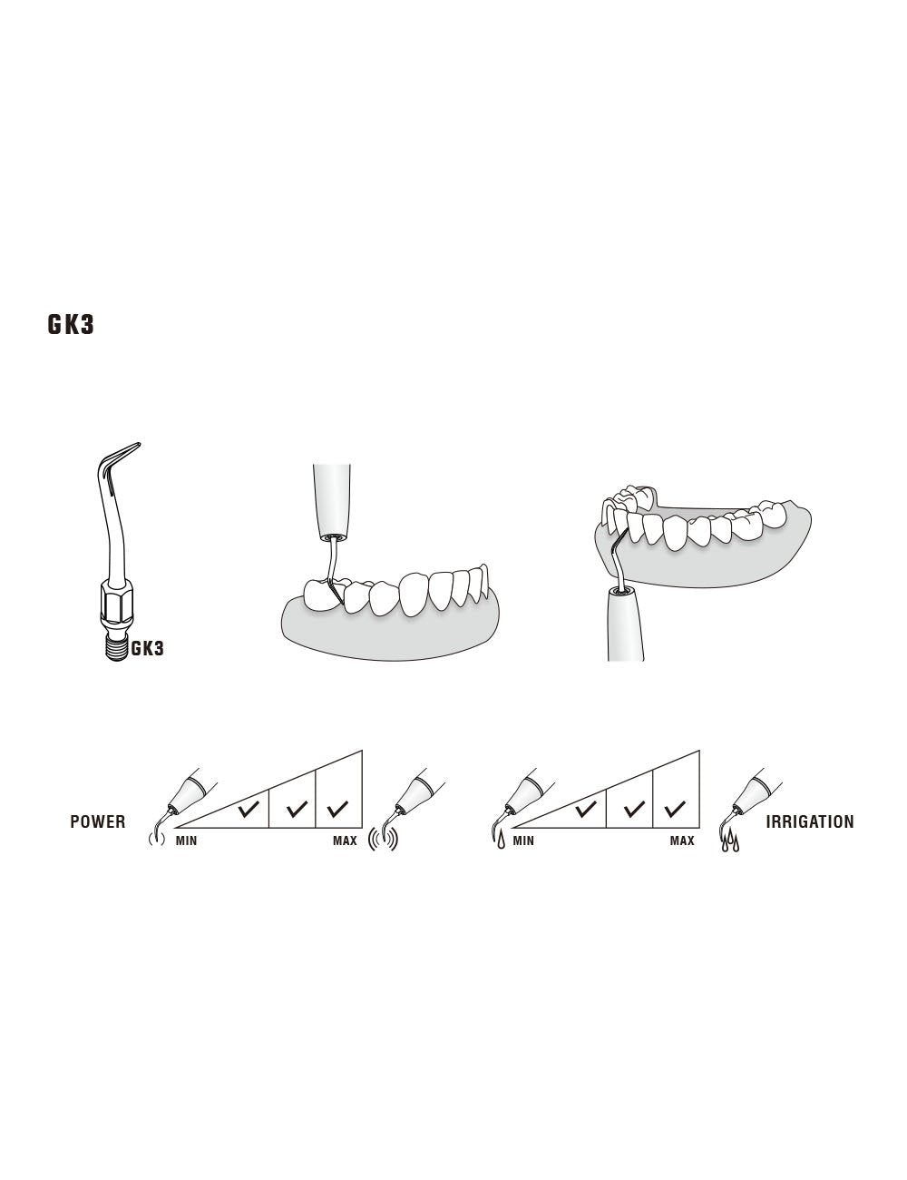 Insert GK3 compatible KAVO - WOODPECKER - oofti.fr