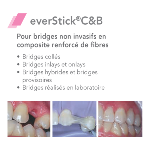 EverStick COMBI Fibre de verre - GC
