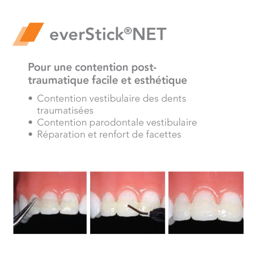 EverStick NET Fiberglass - GC