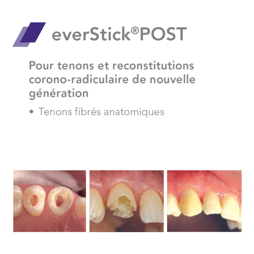 EverStick COMBI Fibre de verre - GC