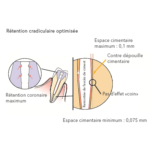 Fibio Fiberglass Posts - Anthogyr