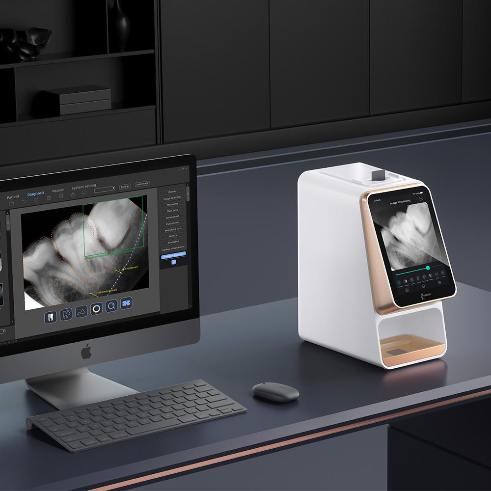 Scanner iScan de plaques d'imagerie avec écran tactile - oofti.fr