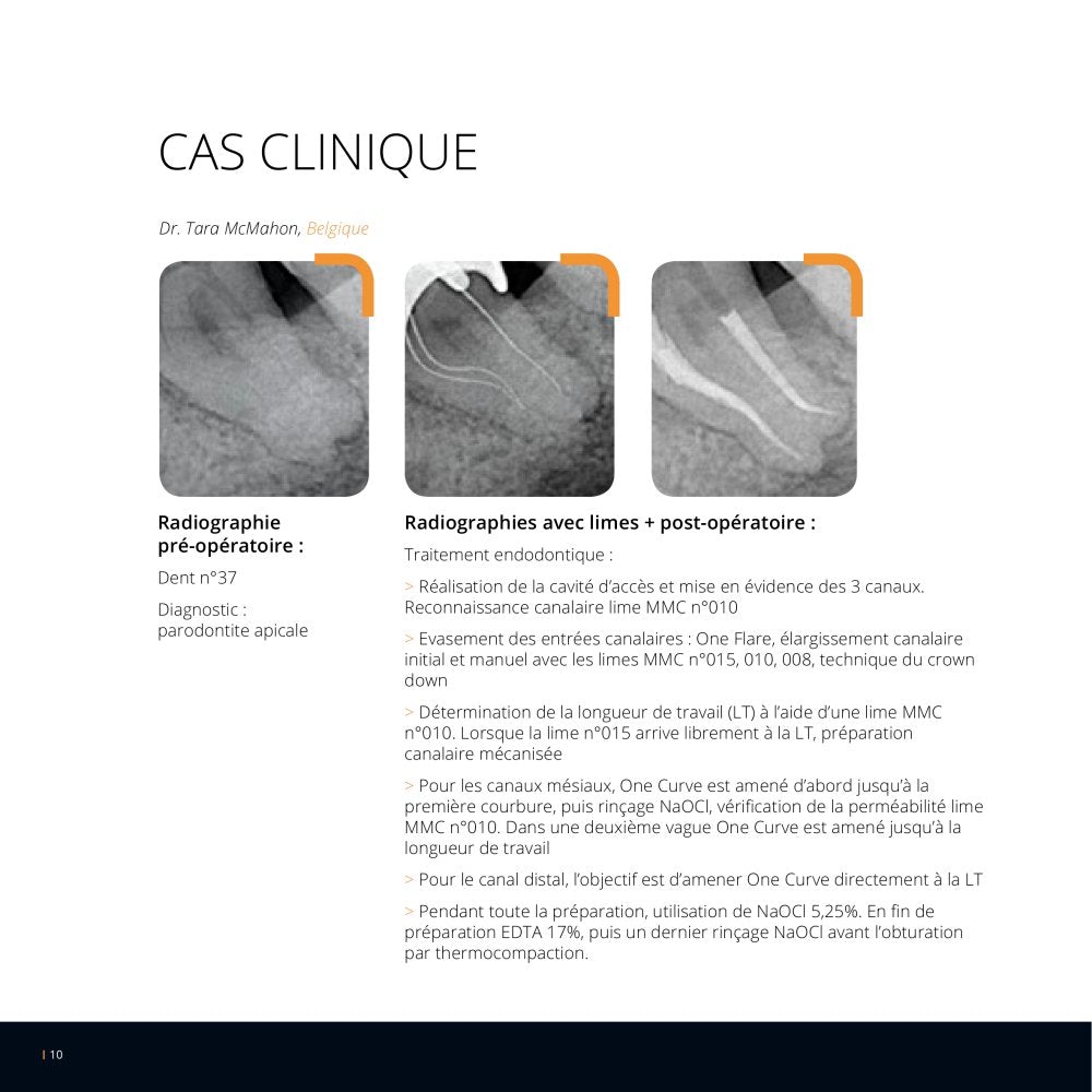 Lot de 6 limes One Curve - 6% conicité MicroMega - Dental Coop