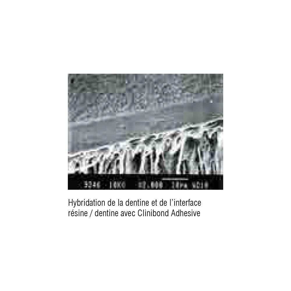 Clinibond Adhesive de Clinix Clinibond Adhesive est un agent de liaison universel amélo-dentinaire de 5e génération monocomposant, photo polymérisable.