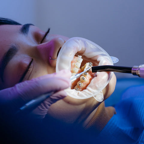 Accessoires orthodontie