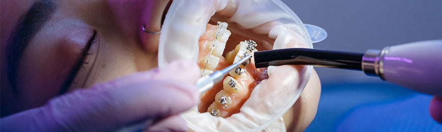 Collage pour brackets et bagues.