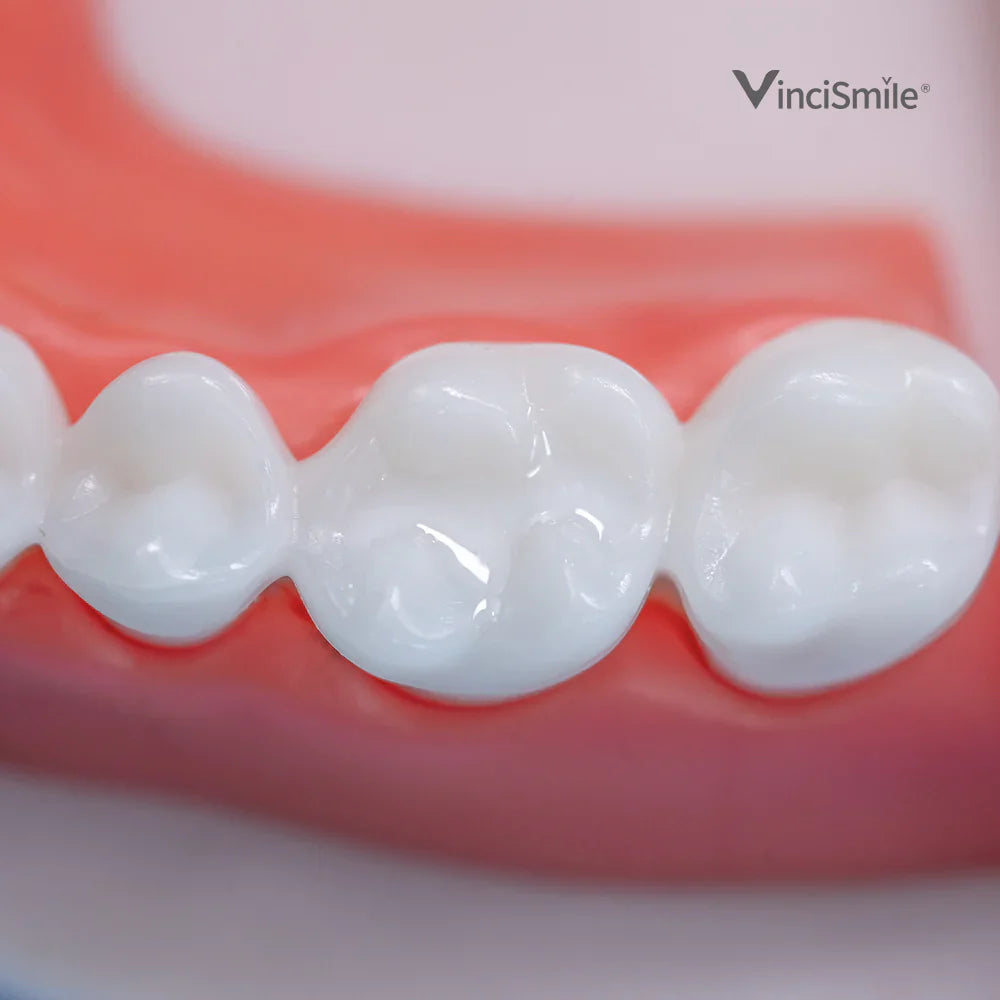 Proseal F Enamel Coating Resin x1 seringue - VINCISMILE  - Dental Coop