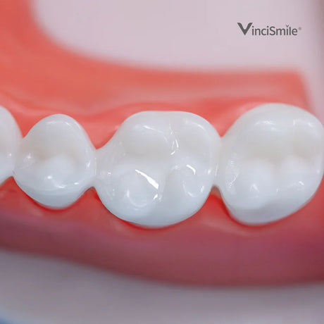 Proseal F Enamel Coating Resin x1 seringue - VINCISMILE  - Dental Coop