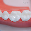 Proseal F Enamel Coating Resin x1 seringue - VINCISMILE  - Dental Coop