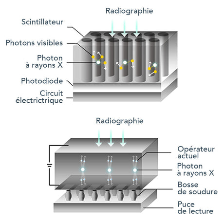 Capteur intra-oral X-ray sensor - XPECT VISION - oofti.fr