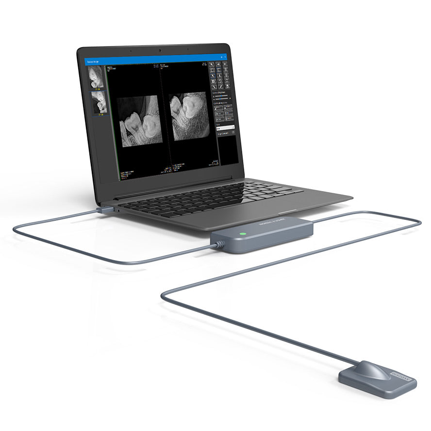 Capteur intra-oral X-ray sensor - XPECT VISION - oofti.fr
