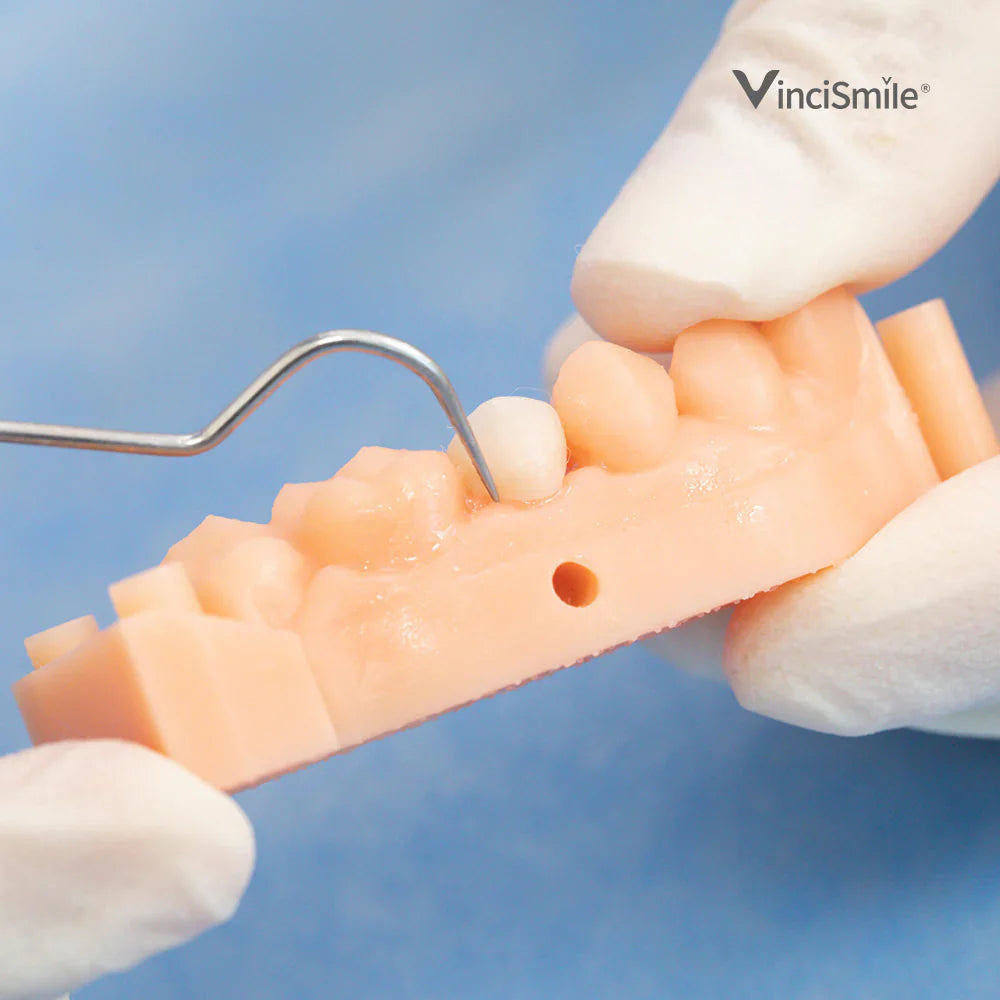 TopCEM Dual Cure Harzzement x1 Spritze - VINCISMILE