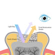 Mimétisme - TrusFIL X-Blend 4g - VinciSmile - Dental Coop