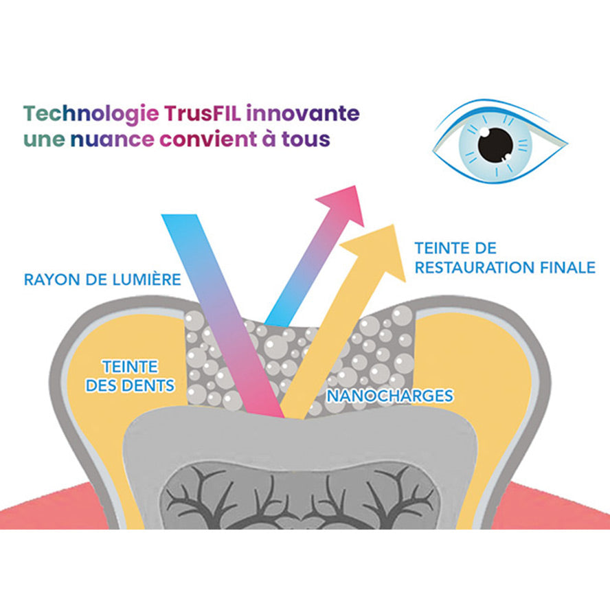 Mimétisme - TrusFIL X-Blend 4g - VinciSmile - Dental Coop