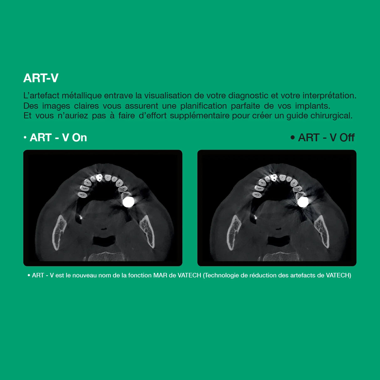 Système d’imagerie 4-en-1 3D / 2D - Green 2 - Vatech - oofti.fr