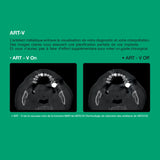 Système d’imagerie 4-en-1 3D / 2D - Green 2 - Vatech - oofti.fr
