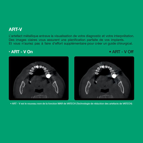 Système d’imagerie 4-en-1 3D / 2D - Green 2 - Vatech - oofti.fr