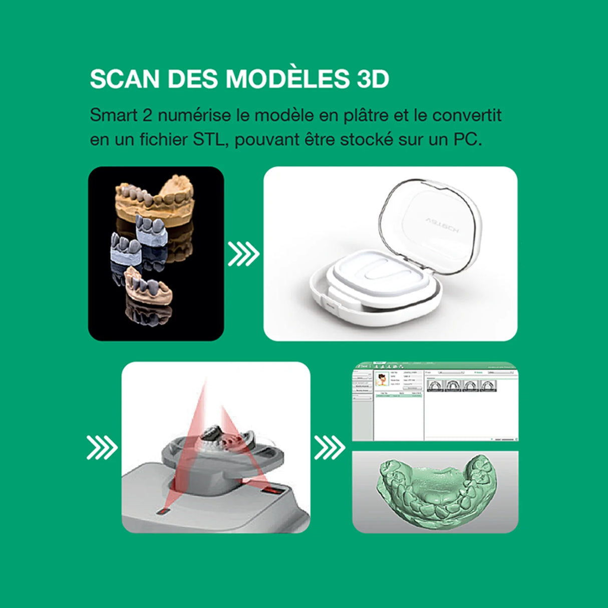 Système d’imagerie CT & panoramique 3D / 2D - Smart 2 - Vatech - oofti.fr